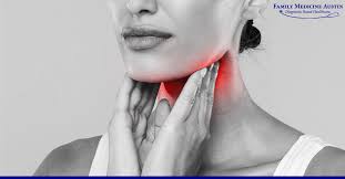 how long does strep throat last fma