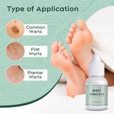 fedoloy wart remover for common warts