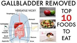 10 Gallbladder Foods Foods To Eat After Gallbladder