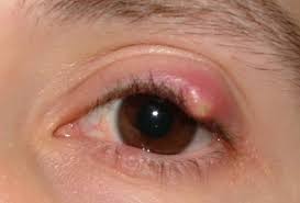 eye disorders understanding the causes