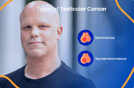 testicular cancer everything you need