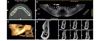 cone beam ct images a axial b