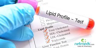 lipid profile test why it is done and