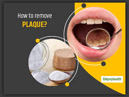 smile freely due to tooth plaque