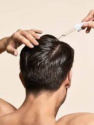 how to apply minoxidil for hair growth