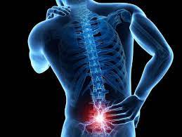 Recent clinical trial discovers vitamin D supplementation reduces chronic low back pain - PRO-D
