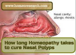 how long homeopathy takes to cure nasal