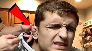 Do all mma fighters have cauliflower ear? Why Do Mma Fighters Have Weird Ears This Mma Life