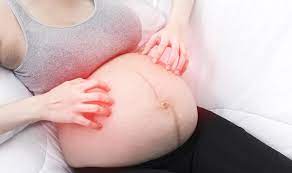 remes for itching during pregnancy