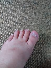 Disguise Missing Toe Nail