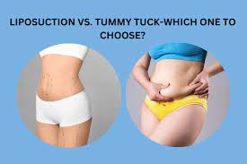 liposuction vs tummy tuck nyc find out