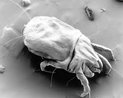 how to easily reduce dust mites in your