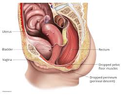 perineal descent austin urogynecology