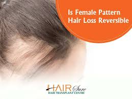 is female pattern hair loss reversible