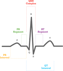 What Is An Ecg