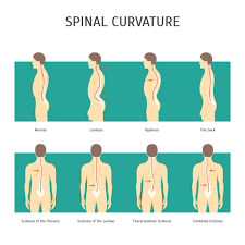 The pain may be caused by. Lower Back Pain Causes Treatments Exercises Back Pain Relief