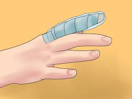 3 formas de colocar uma tala no dedo