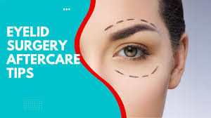eyelid surgery aftercare tips 2023