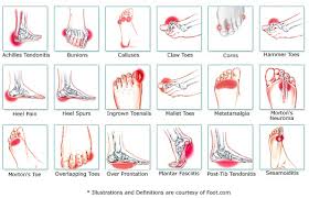 Foot Pain Location Chart Foot Chart For Pain Type Of Feet