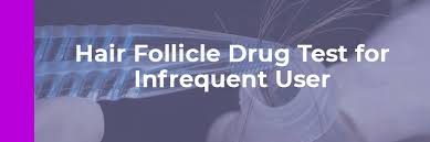 Results for confirmation testing of presumptive positive screens are usually available within an additional 72 hours. Hair Follicle Drug Test For Infrequent User My Time Recovery