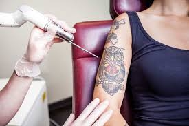 eraditatt tattoo removal