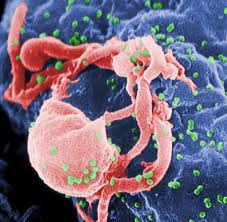Gilt aids nach wie vor als schwulenkrankheit? Aids Erreger Hiv Infizierte Ohne Behandlung Jahrelang Symptomfrei Welt