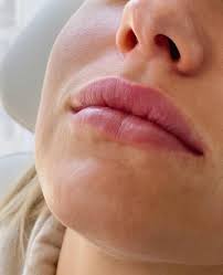 moisturizing lip filler beautiful
