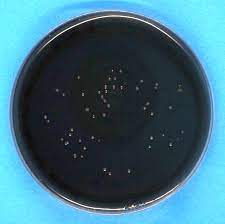 bcye agar plate with visible colonies