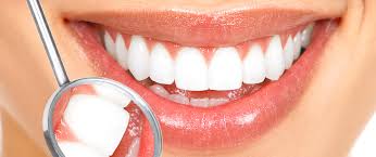 diş beyazlatma spreyi ile ilgili görsel sonucu