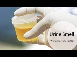 why does my urine smell like fish