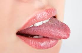 what your tongue says about your health