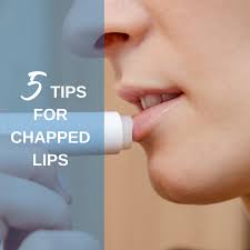 dry ed lips try these 5 tips for
