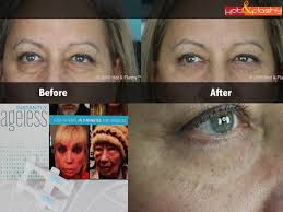 instantly ageless complete review