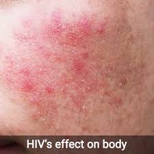 body if you are infected with hiv