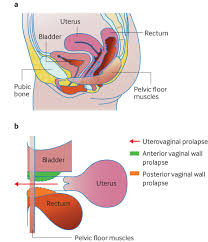 how strong is your pelvic floor by