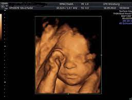 Ein unvergessliches, bewegendes erlebnis für werdende mütter und väter ist ein 3d ultraschall bild ihres babys. Dein Baby In 3d Was Bietet Ein 3d Ultraschall Und Wann Ist Er Erlaubt Netmoms De