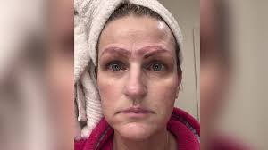botched microblading procedure leaves