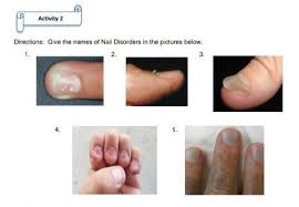 give the names of nail disorders in the