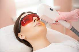 laser treatment for santa ynez and