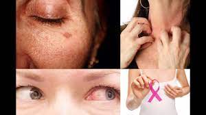 harmful effects of cosmeticakeup