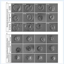 Morphological Grading A Classification Of Blastocyst