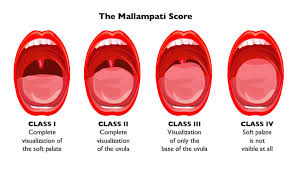 understanding the mallati score