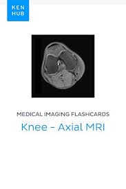 The muscles of the knee include the quadriceps, hamstrings, and the muscles of the calf. Medical Imaging Flashcards Knee Axial Mri Learn All Bones Ligaments Muscles Mri Arteries Nerves And Veins On The Go Kenhub Flashcards Book 54 Kindle Edition By Kenhub Kenhub Professional