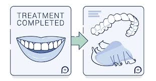 The length of time it takes for your bone to solidify and further stabilize your corrected alignment will vary and may depend on factors that are beyond your control, even if you wear your retainer. All You Need To Know About Orthodontic Retainers Braces Vs Retainers