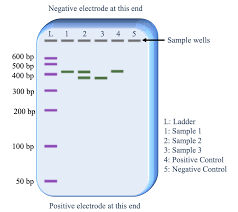 pcr and gel electropsis genetics