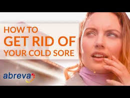 how to get rid of a cold sore cold