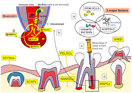 apical periodonis treatment