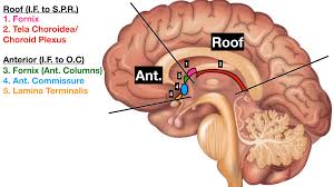 ventricles of the brain labeled