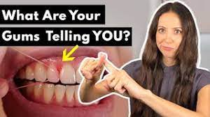 why do gums hurt bleed after flossing