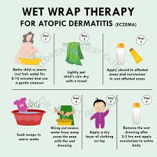 atopic dermais or eczema wet wraps